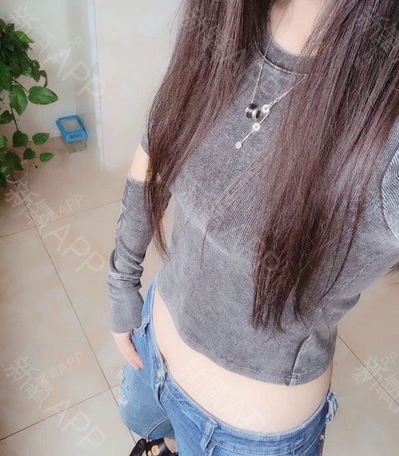 噜啦噜啦lu吸脂瘦腰部第19天美丽日记-新氧美