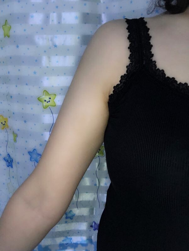 效果显现期射频溶脂瘦手臂第62天           ·           第4篇日记
