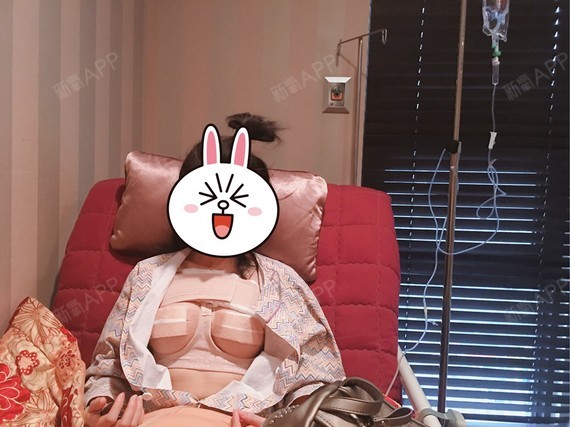 隆胸275cc效果图,曼托250cc和275效果图 新氧- 圆圆圆玉儿 | 胸部 | 隆胸 | 乳头 | 假体隆胸 | 乳头整形 | 术