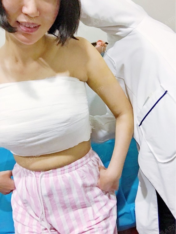小婶婶__假体隆胸第3天美丽日记