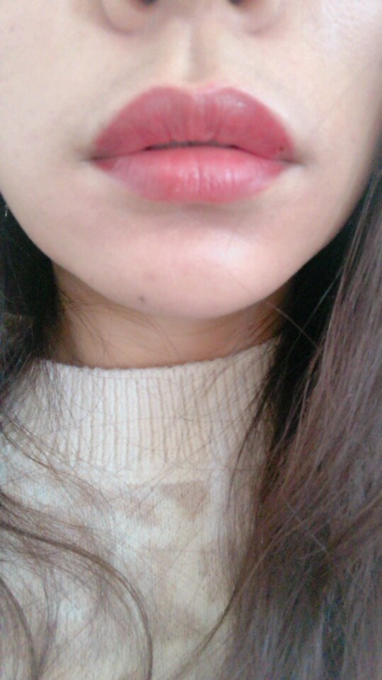 半永久纹唇怎么样_恢复过程_效果如何_氧气xwsed整形.