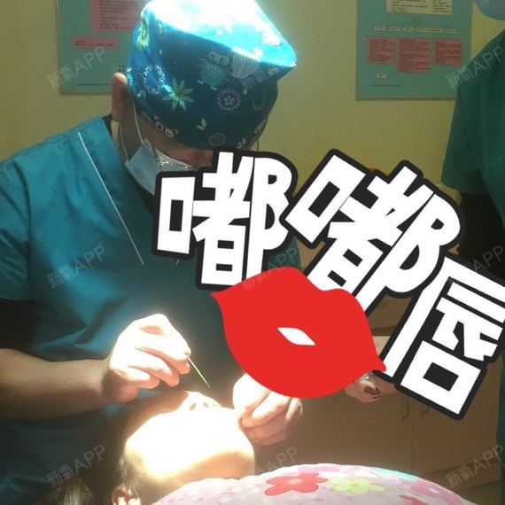 m唇手术