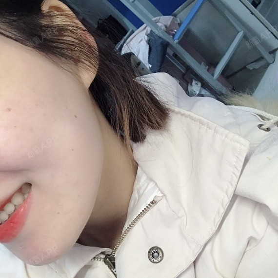 新氧-你的肥肥|瘦脸面部|肉毒素轮廓|肉无氧|术后当自强减脂需要做毒素图片