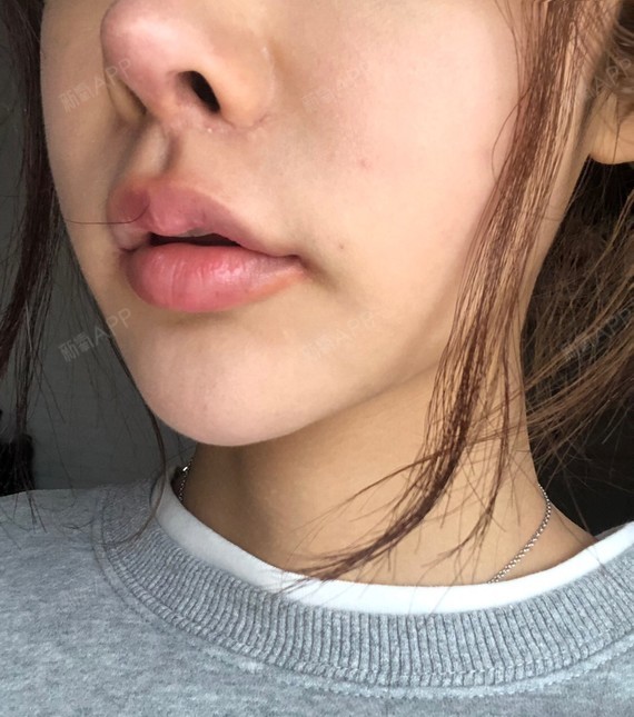 一起哇哈哈哈嘴角上扬术第237天美丽日记
