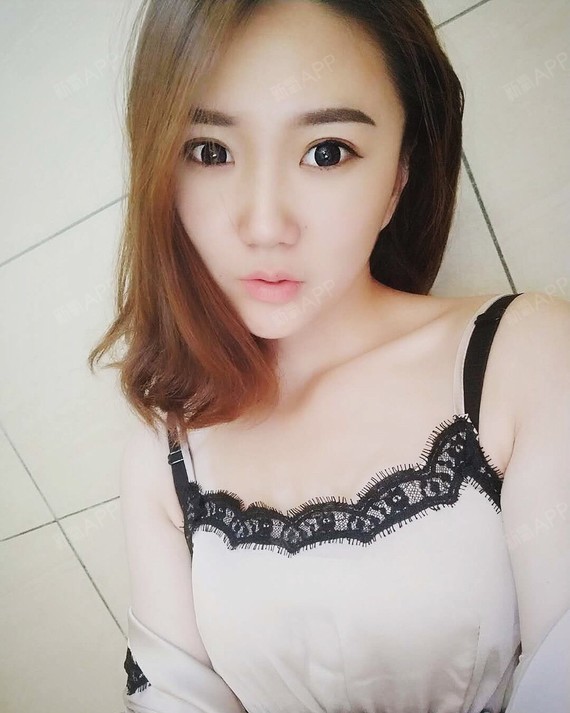 幸福兔宝宝激光紧缩阴道第1天美丽日记-新氧美