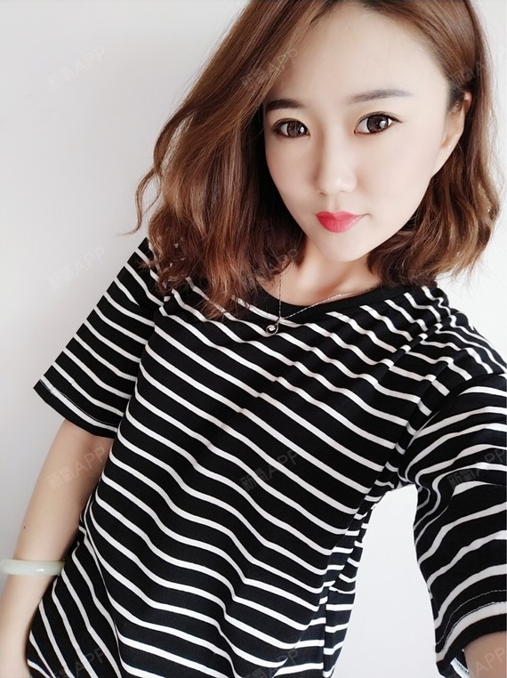 幸福兔宝宝激光紧缩阴道第1天美丽日记-新氧美