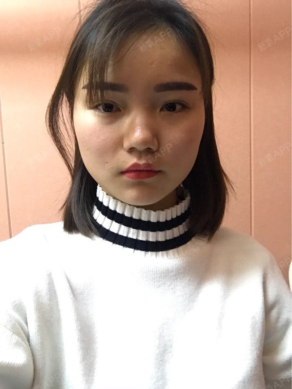 独木桥71肉星期瘦脸第6天美毒素记怎样节食一个丽日瘦10斤图片