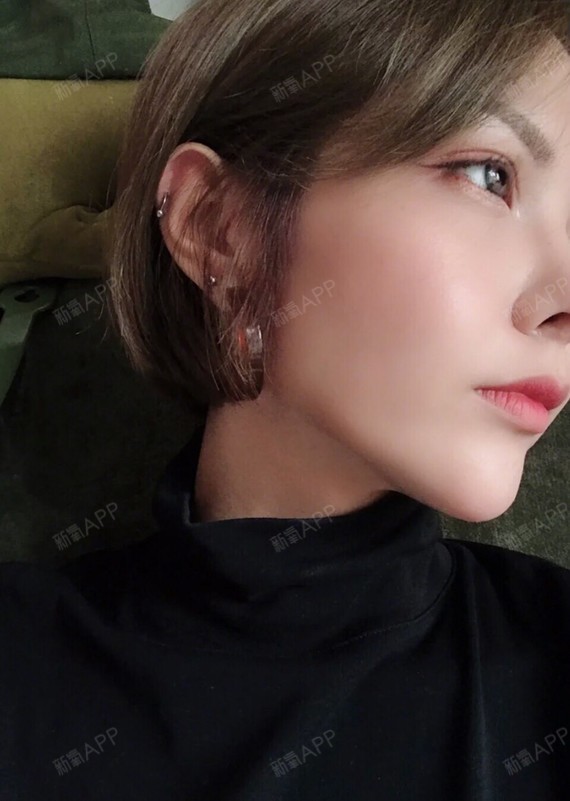 玻尿酸隆下巴