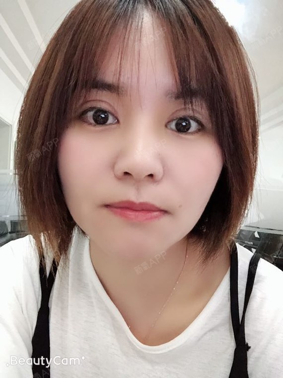 现在的眼睛真的很喜欢,每天都在发朋友圈自拍的我,感觉离被屏蔽不远了