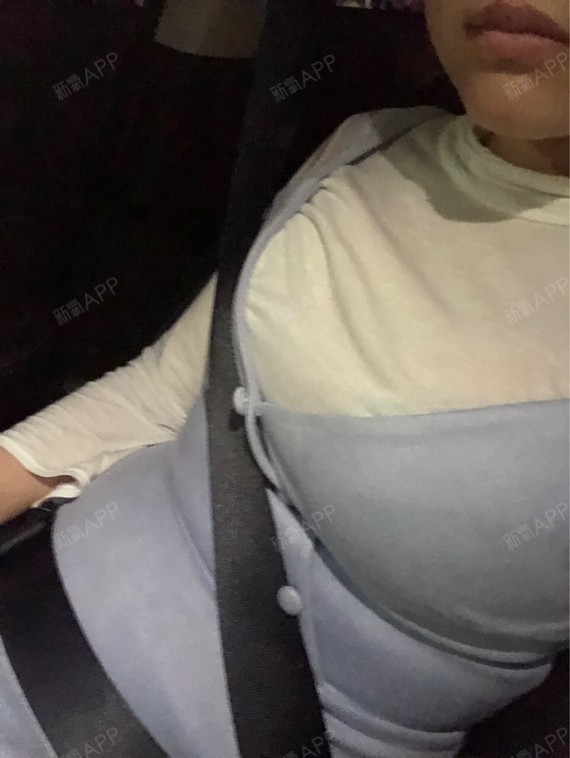 自体脂肪隆胸