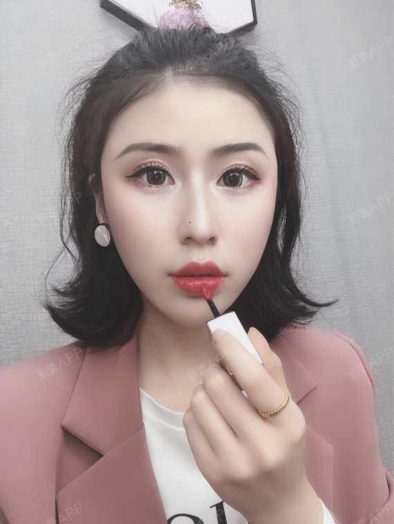 m唇手术好不好_效果图_尚恩小盆友m唇手术术后第41天_新氧美容整形