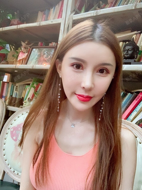 玻尿酸丰唇好不好_效果图_下至日玻尿酸丰唇术后第13