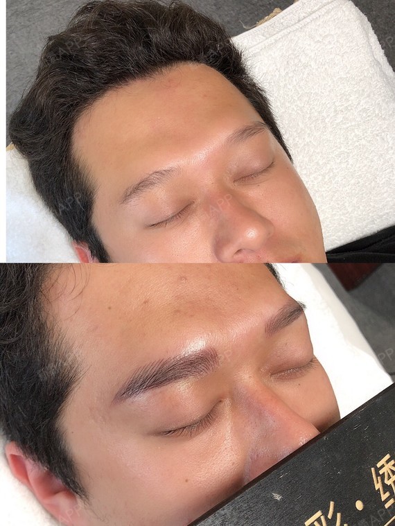 北京男士纹眉自身体验