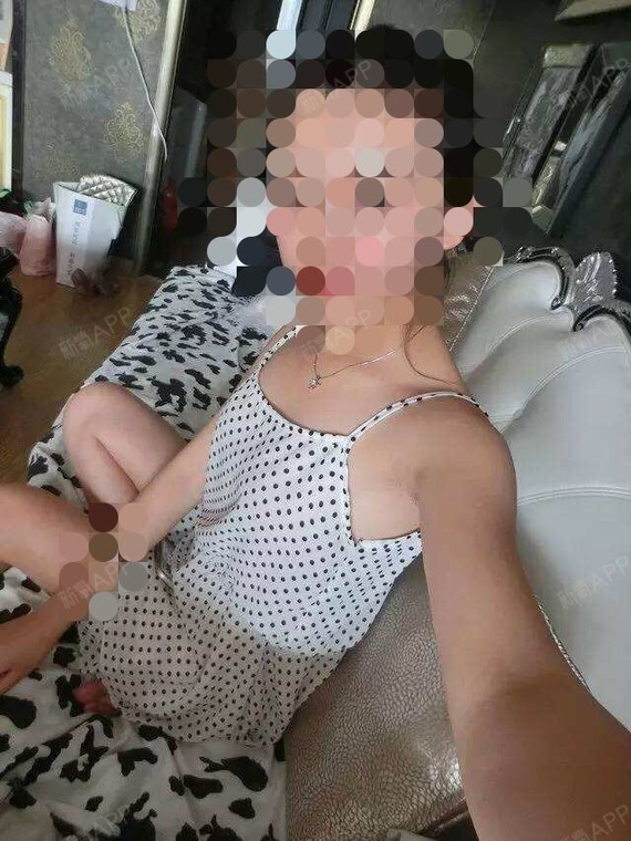 成都假体隆胸好不好_效果图_氧气2kzto假体隆胸术后第