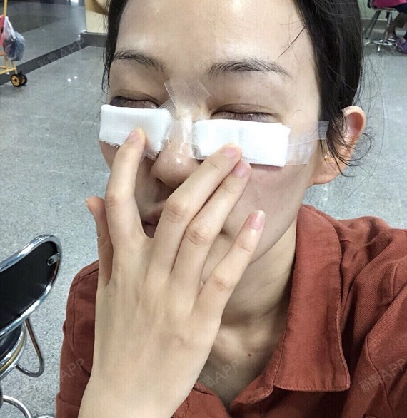 这一张是手术完出科室门口,外部无伤口,是给压力纱布