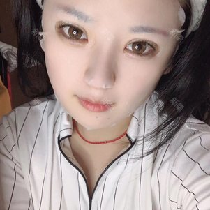 固颜依美亚洲整形眼部多项怎么样_恢复过程_效果如何_氧气4nzbz整形