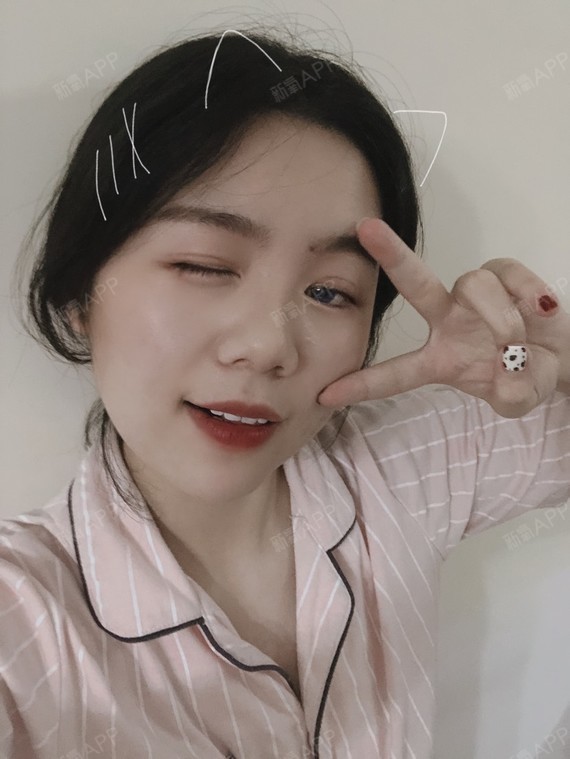 埋线双眼皮好不好_效果图_氧气3t791埋线双眼皮术后第