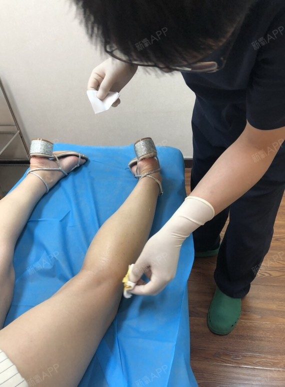 注射瘦小腿