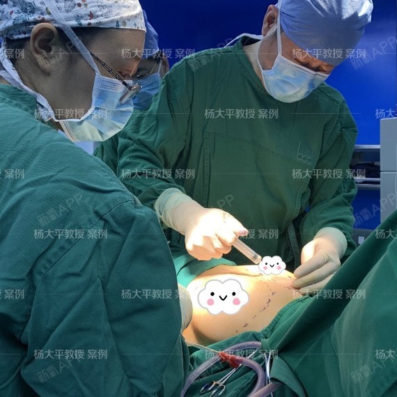 假体隆胸