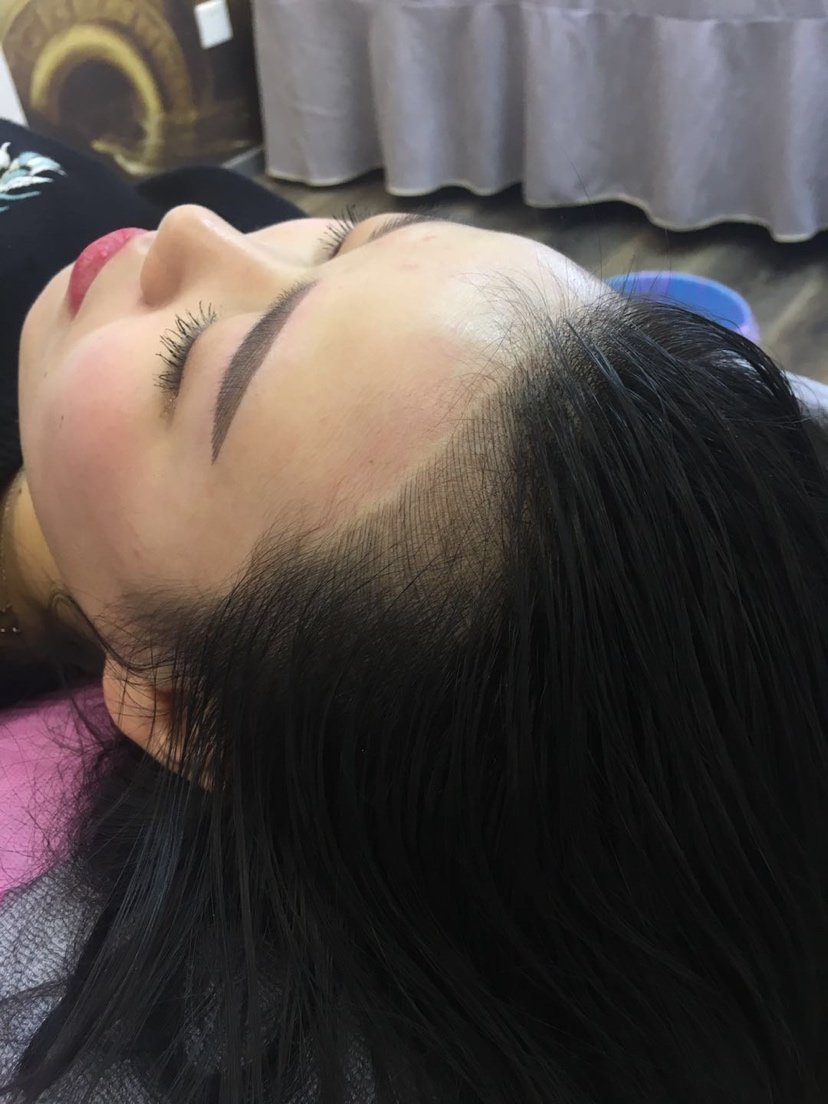 直觉得自己的大额头不是很美观,明明发量很 多为啥发际线却这么高纹绣