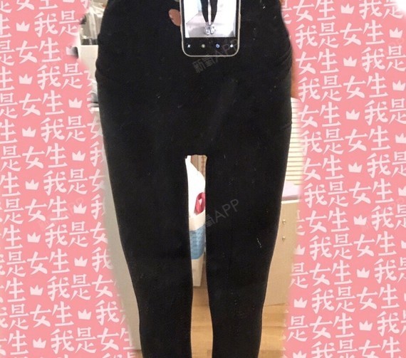还有4天腿就满月子了,现在除了膝盖上还有点淤青,没