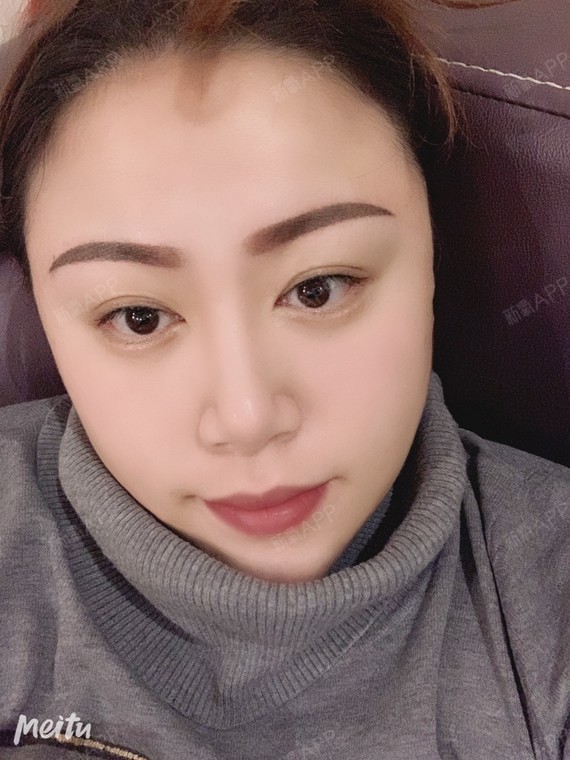 第一天,刚做完了半永久纹眉,是感觉变化挺大的,以前的眉毛稀疏,化妆