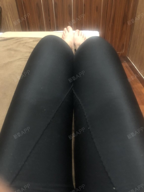 现在淤青和肿痛都消失了,不过膝盖还是有点粗,医生说我应该是膝盖处的