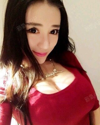 术后胸型很好看,没有任何不适症状,非常满意,感谢丁医生