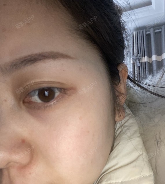 我真的是沙漠干皮星人了,一天不敷面膜脸都炸皮