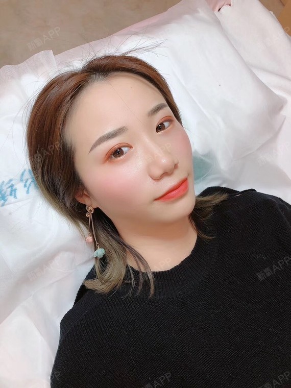 现在纹好眉十几天了,同事们都夸我眉毛自然 非常值得的一次纹眉.
