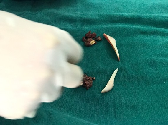 型不满意有很多原因,有的求美者仅仅是骨骼问