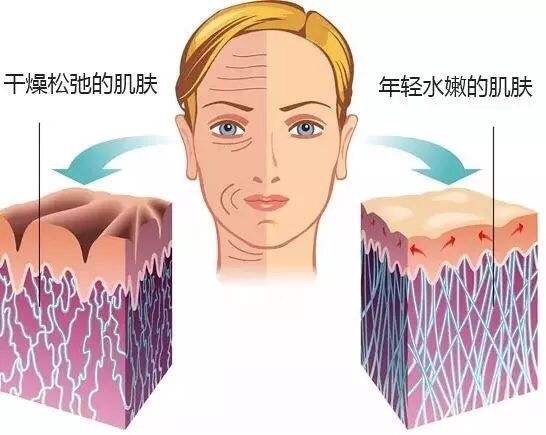 为什么打完水光针一点效果都没有?水光针打一