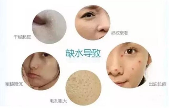 为什么打完水光针一点效果都没有?水光针打一