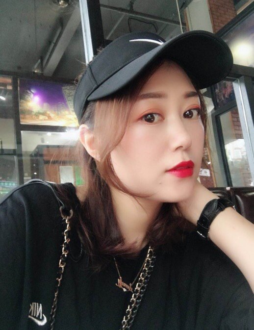 激光祛斑会留疤,是真的吗?祛斑,最经典有效的