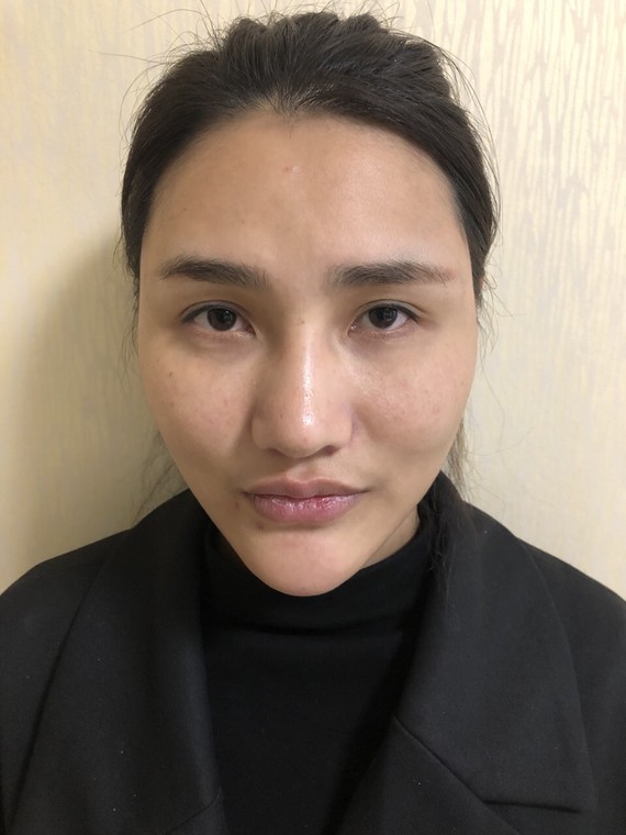 天庭饱满是你脸部美学的重要因素