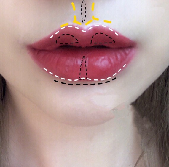 少了花瓣唇,在漂亮的姑娘也差点意思?