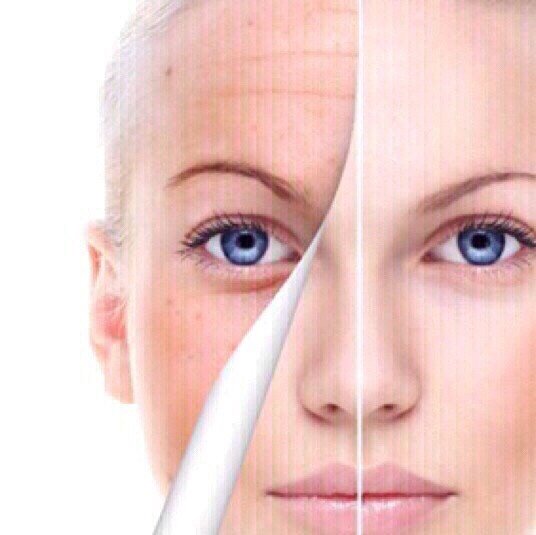 ACMETEA激光祛斑危害ACMETEA激光祛斑有