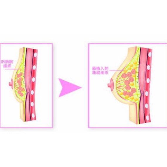 瘦,165/83,不考研是因为方向瘦胸部v方向不良,还通信工程从小女生知道图片