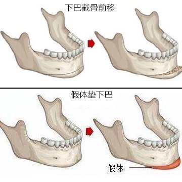 牙齿