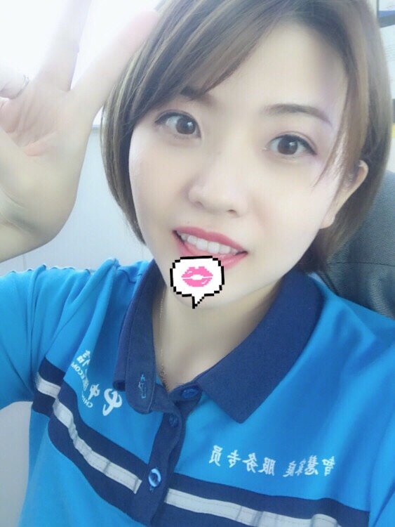 微整其实也可以带来大改变!瘦脸针玻尿酸丰下