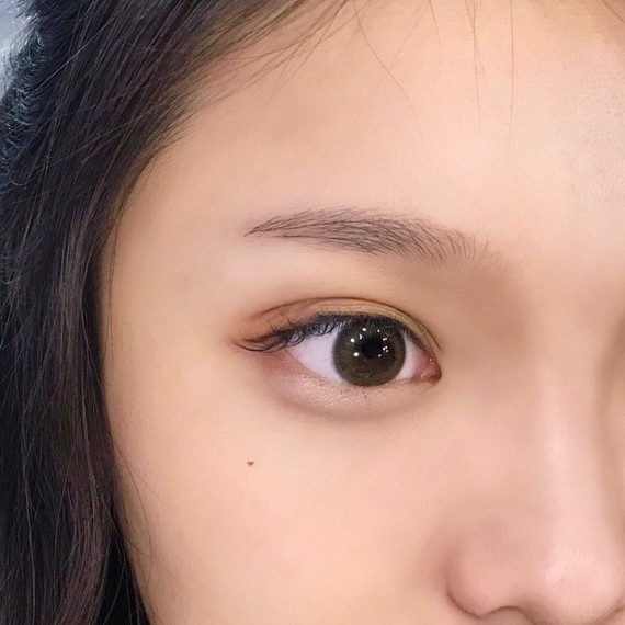 种植眉毛