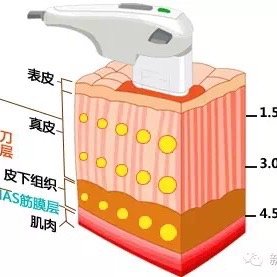 what?谁说注射瘦脸针会让皮肤松弛下垂的!Are