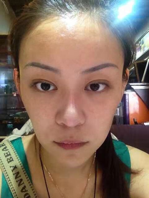 【济南探店】PRP水光针!让我皮肤快速水润白