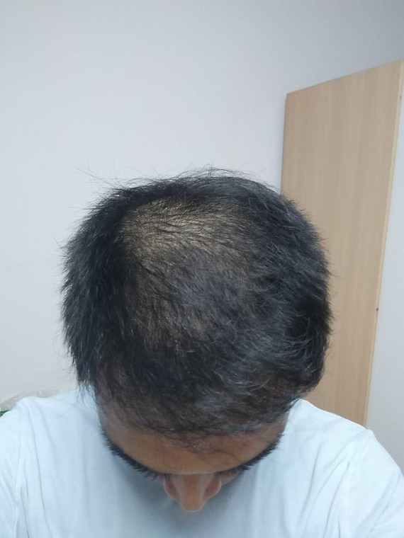 不到三个月年轻10岁,工作业绩飙升!我是一名销