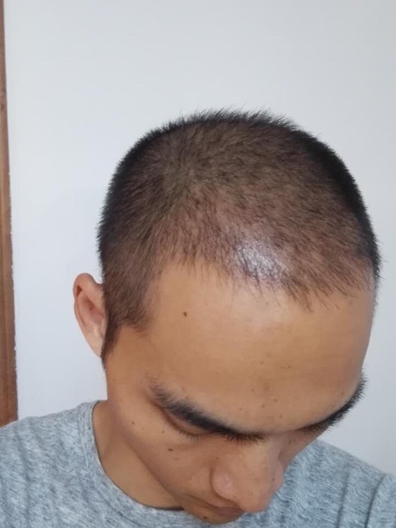 不到三个月年轻10岁,工作业绩飙升!我是一名销