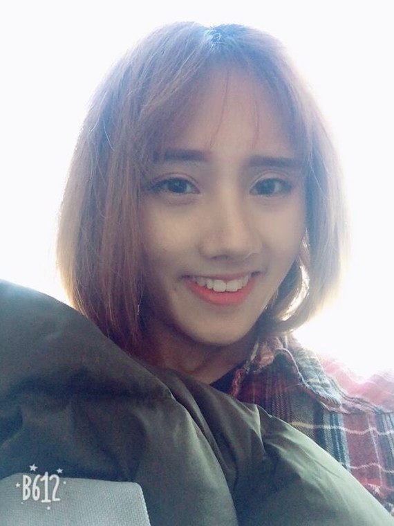 隆鼻取出假体多久恢复一些爱美的宝贝在隆鼻手