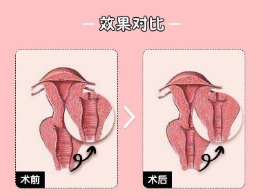 05女性性功能抗衰看这里!05049969♀15♀