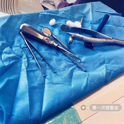 带着专业牙医分享我的拔智齿经验,早拔早轻松