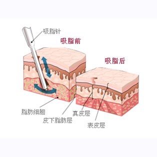 如何缩胸?比平胸妹纸,超大的胸部给女性带来的