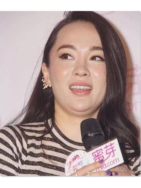 怎么瘦双下巴最有效选择吸脂好还是溶脂针好双